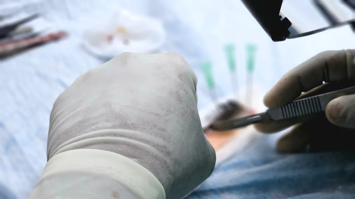 Are Hair Transplants Covered by Insurance? A Detailed Look Are Hair Transplants Covered by Insurance? A Detailed Look